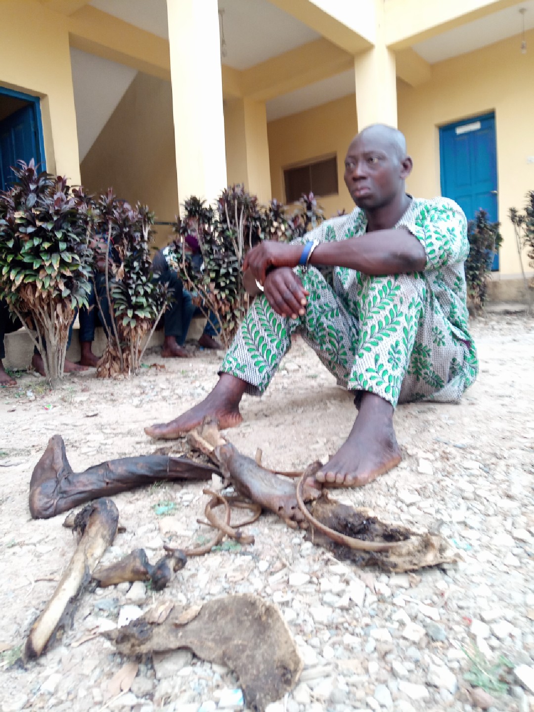 Man Arrested For Unlawful Possession of Human Parts In Osun